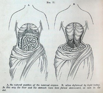 Silhouette of Women's Fashions – The History of the Corset - Hagen History Center